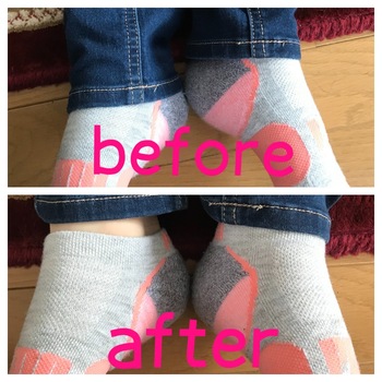 足の長さのバランス崩れが原因のこともあります