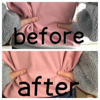 骨盤の歪みが不調の原因のこともあります