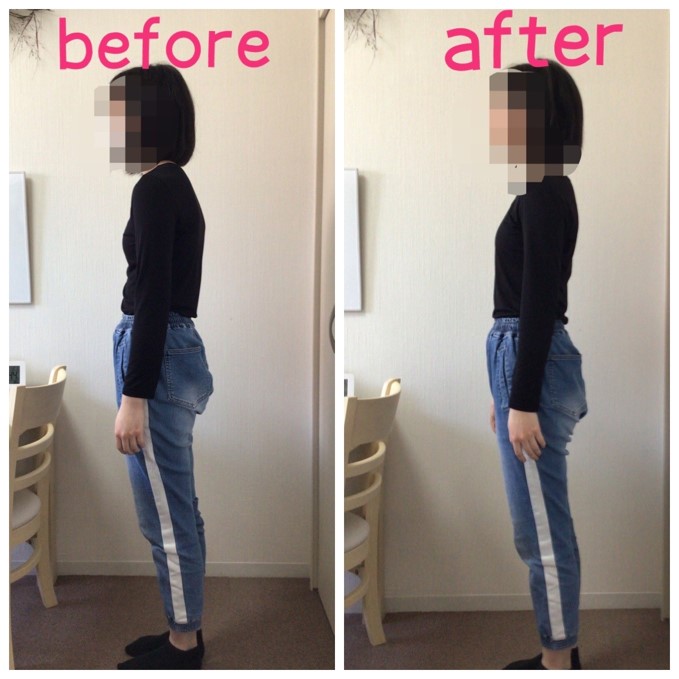 姿勢矯正で猫背を改善